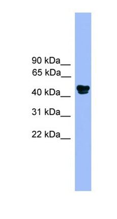 ALDH3A1 antibody