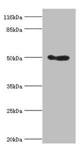ALDH3A1 Antibody