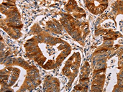 ALDH3A1 Antibody