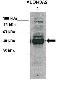 ALDH3A2 antibody