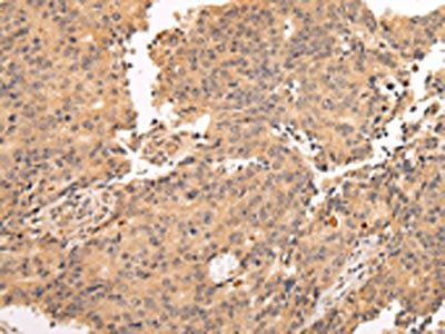 ALDH3A2 Antibody