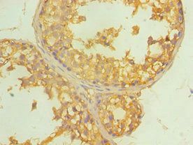 ALDH4A1 antibody