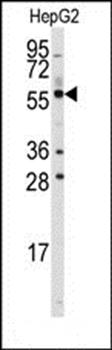 ALDH4A1 antibody