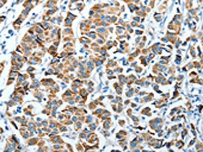 ALDH4A1 antibody