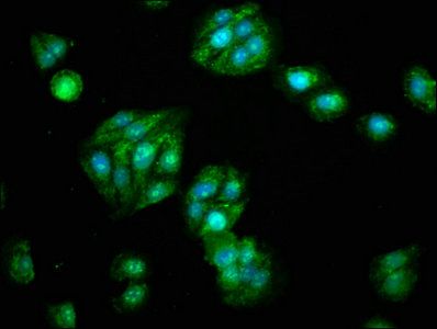 ALDH5A1 antibody