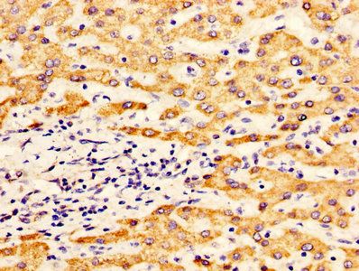 ALDH5A1 Antibody