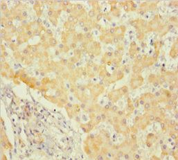 ALDH5A1 Antibody