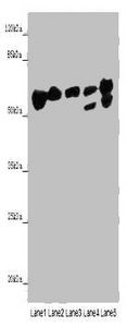 ALDH5A1 Antibody
