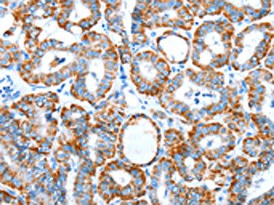 ALDH5A1 Antibody
