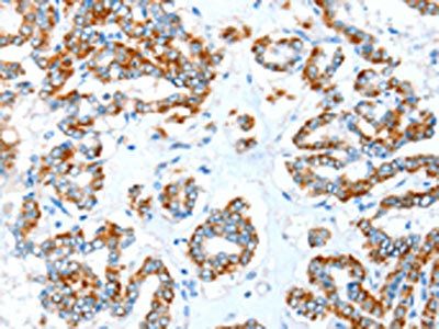 ALDH5A1 Antibody