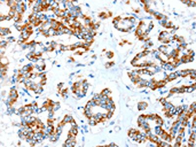 ALDH5A1 antibody