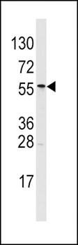ALDH6A1 antibody