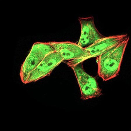 ALDH6A1 Antibody