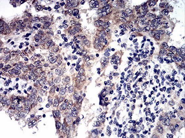 ALDH6A1 Antibody