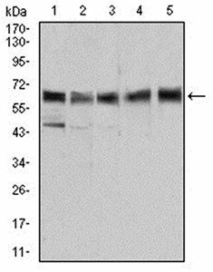 ALDH6A1 Antibody