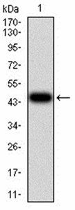 ALDH6A1 Antibody