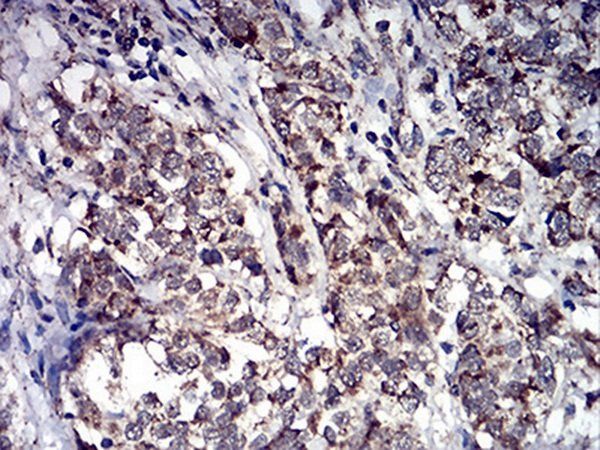 ALDH6A1 Antibody