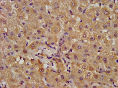 ALDH7A1 Antibody