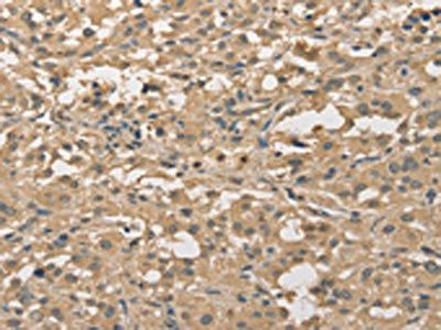 ALDH8A1 Antibody