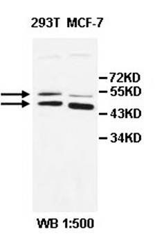 ALDH8A1 Rabbit Polyclonal Antibody