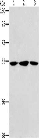ALDH9A1 Antibody
