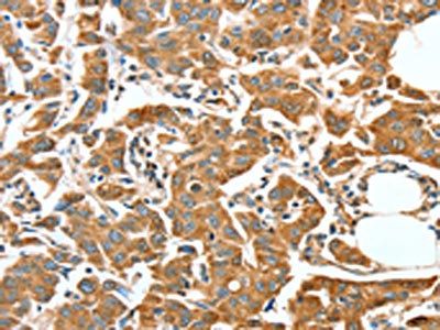 ALDH9A1 Antibody