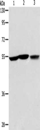 ALDH9A1 antibody