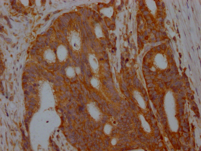 ALDOA Recombinant Monoclonal Antibody