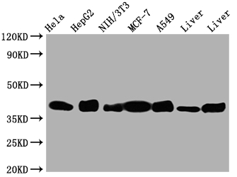 ALDOA Recombinant Monoclonal Antibody