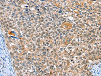 ALDOB Antibody