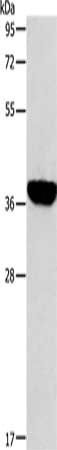 ALDOB Antibody