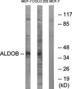 ALDOB Antibody
