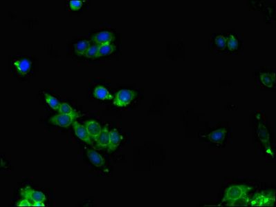 ALDOC Antibody