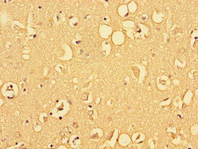 ALDOC Antibody