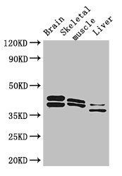 ALDOC Antibody