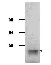 Aldolase antibody (Peroxidase)