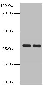 Aldose 1-epimerase antibody