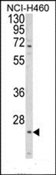 ALG14 antibody