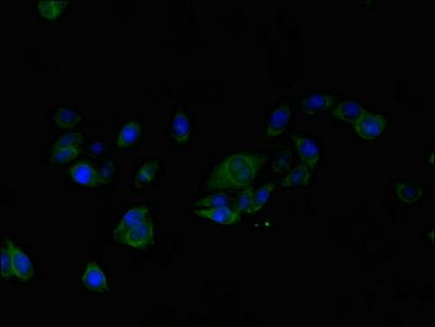 ALG2 antibody