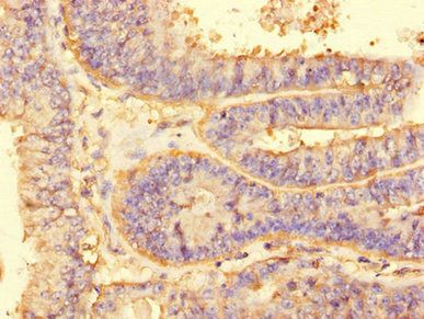ALG2 Antibody