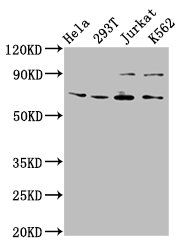 ALG9 antibody