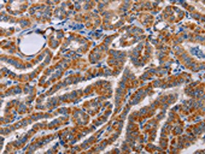 ALG9 Antibody
