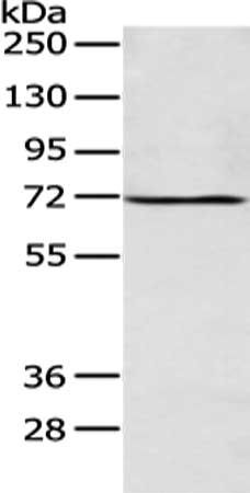 ALG9 antibody