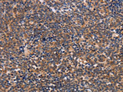 ALG9 Antibody