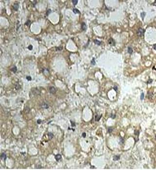 ALG9 Rabbit Polyclonal Antibody