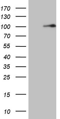 ALK Antibody