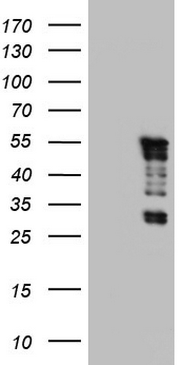ALK Antibody
