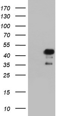 ALK Antibody