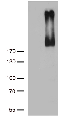 ALK Antibody
