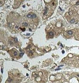 ALKBH1 Rabbit Polyclonal Antibody